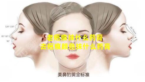 老疤痕抹什么药膏 去疤痕颜色抹什么药膏